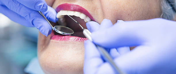 Best Broken or Chipped Tooth Repair in St Albans, WV